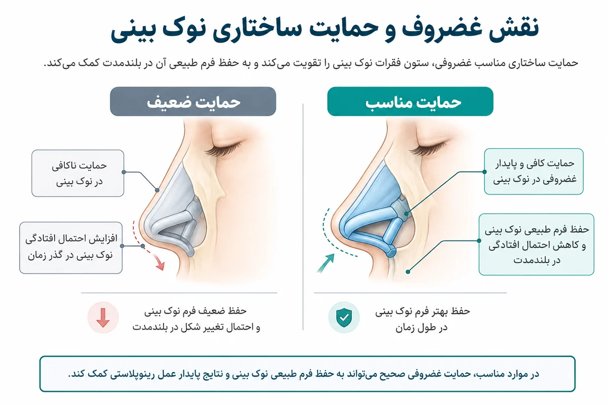 اینفوگرافیک نقش غضروف و حمایت ساختاری در حفظ فرم نوک بینی