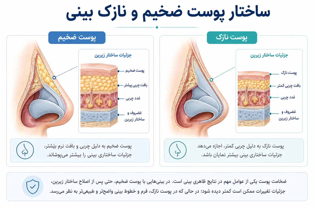 اینفوگرافیک مقایسه ساختار پوست ضخیم و پوست نازک بینی