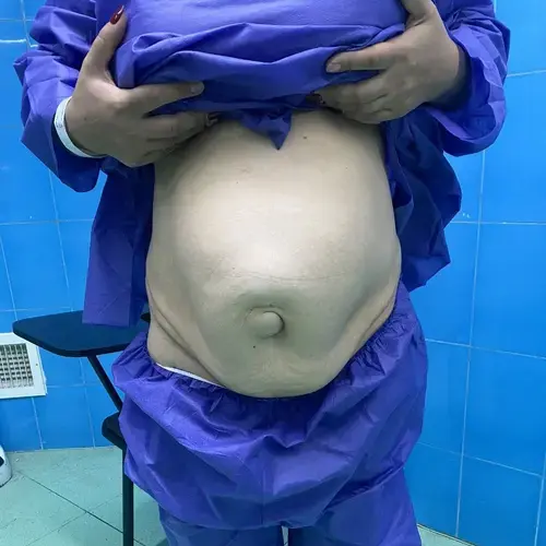 photo_2025-07-06_22-09-41-ezgif.com-crop photo_2025-07-06_22-09-41-ezgif.com-crop