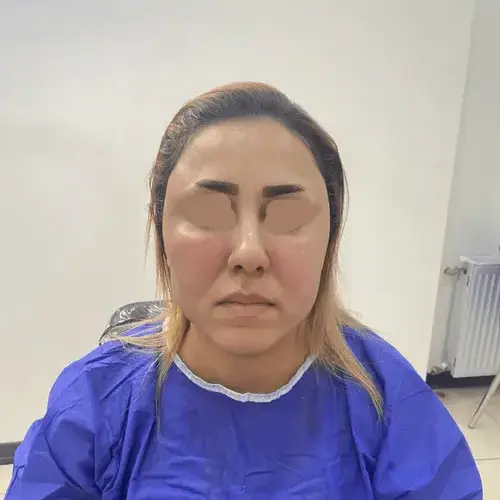 photo_2025-07-06_22-09-432-ezgif.com-crop