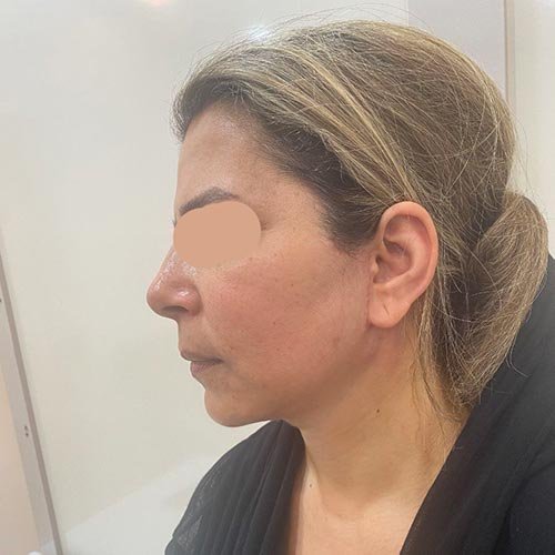 photo_2025-07-06_22-09-48 (3)