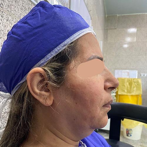 photo_2025-07-06_22-09-49 میدفیس صورت