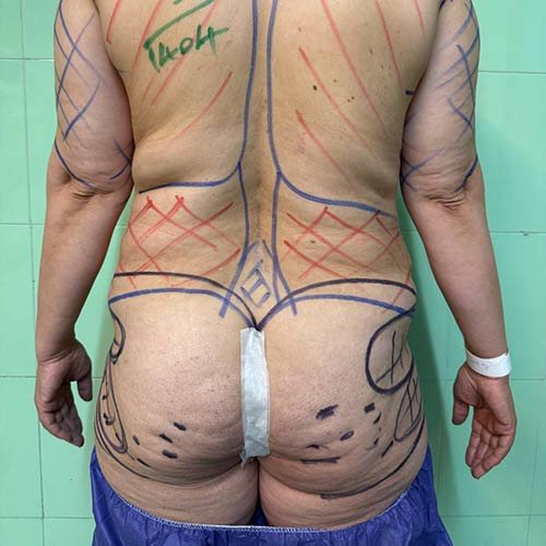 photo_2025-07-06_22-09-54 (2) photo_2025-07-06_22-09-54 (2)