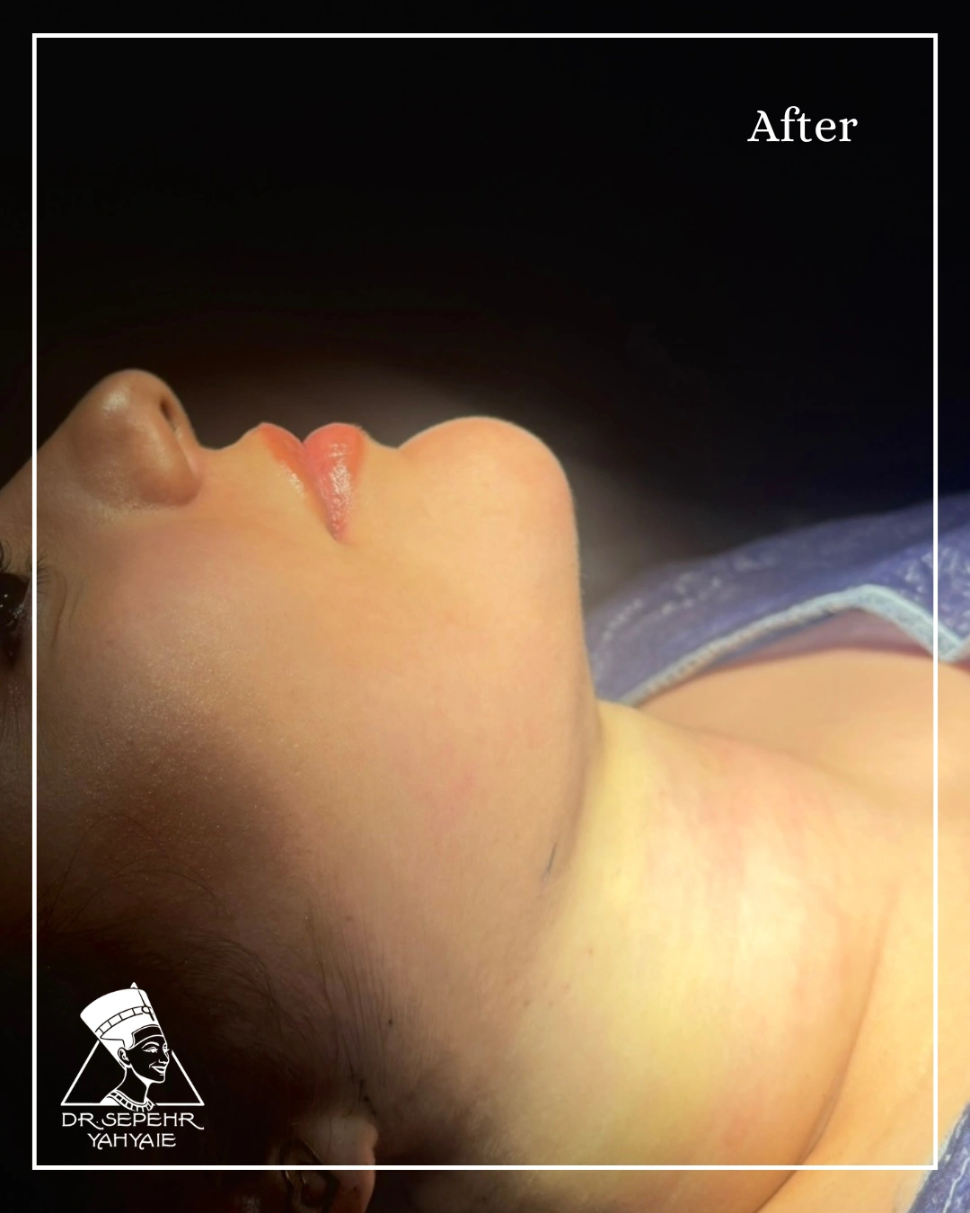 IMG_7105-ezgif.com-jpg-to-webp-converter IMG_7105-ezgif.com-jpg-to-webp-converter