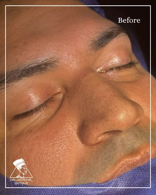 IMG_8637-ezgif.com-jpg-to-webp-converter IMG_8637-ezgif.com-jpg-to-webp-converter