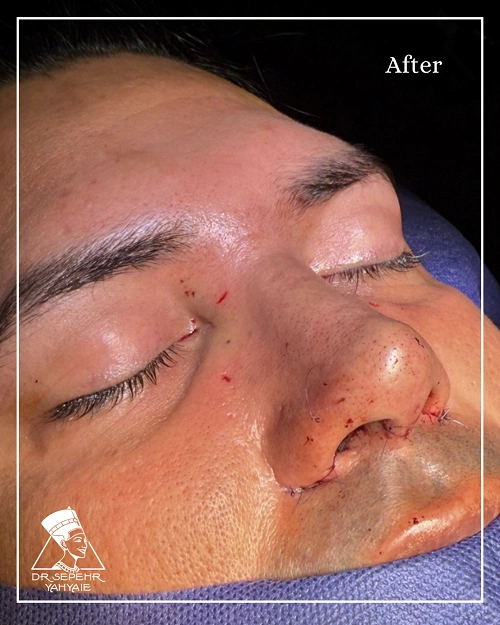 IMG_8639-ezgif.com-jpg-to-webp-converter