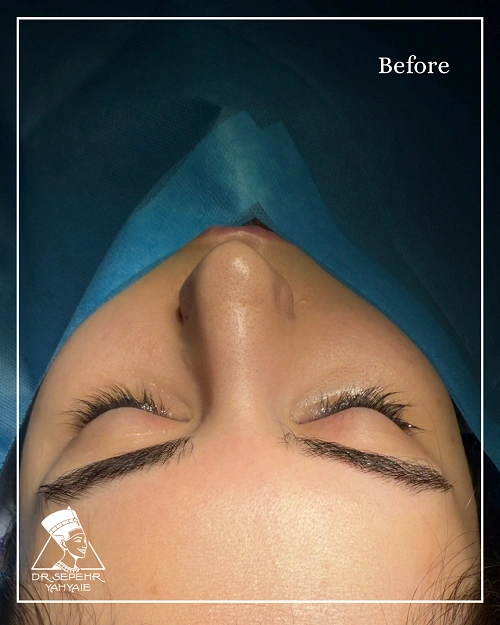 IMG_9622-ezgif.com-jpg-to-webp-converter IMG_9622-ezgif.com-jpg-to-webp-converter