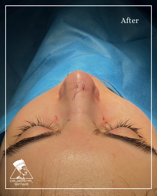 IMG_9623-ezgif.com-jpg-to-webp-converter